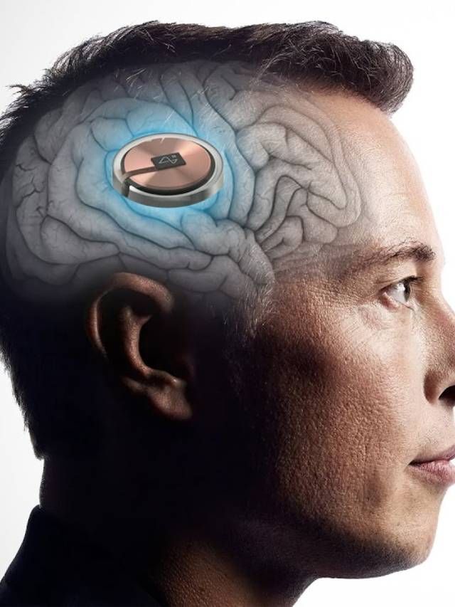 Neuralink and its Impact